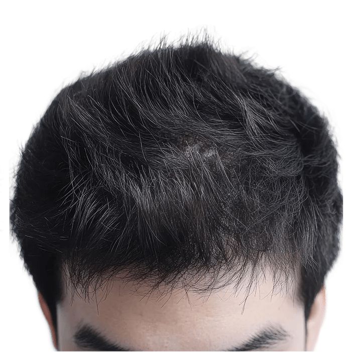 Hair Regrowth Protocol